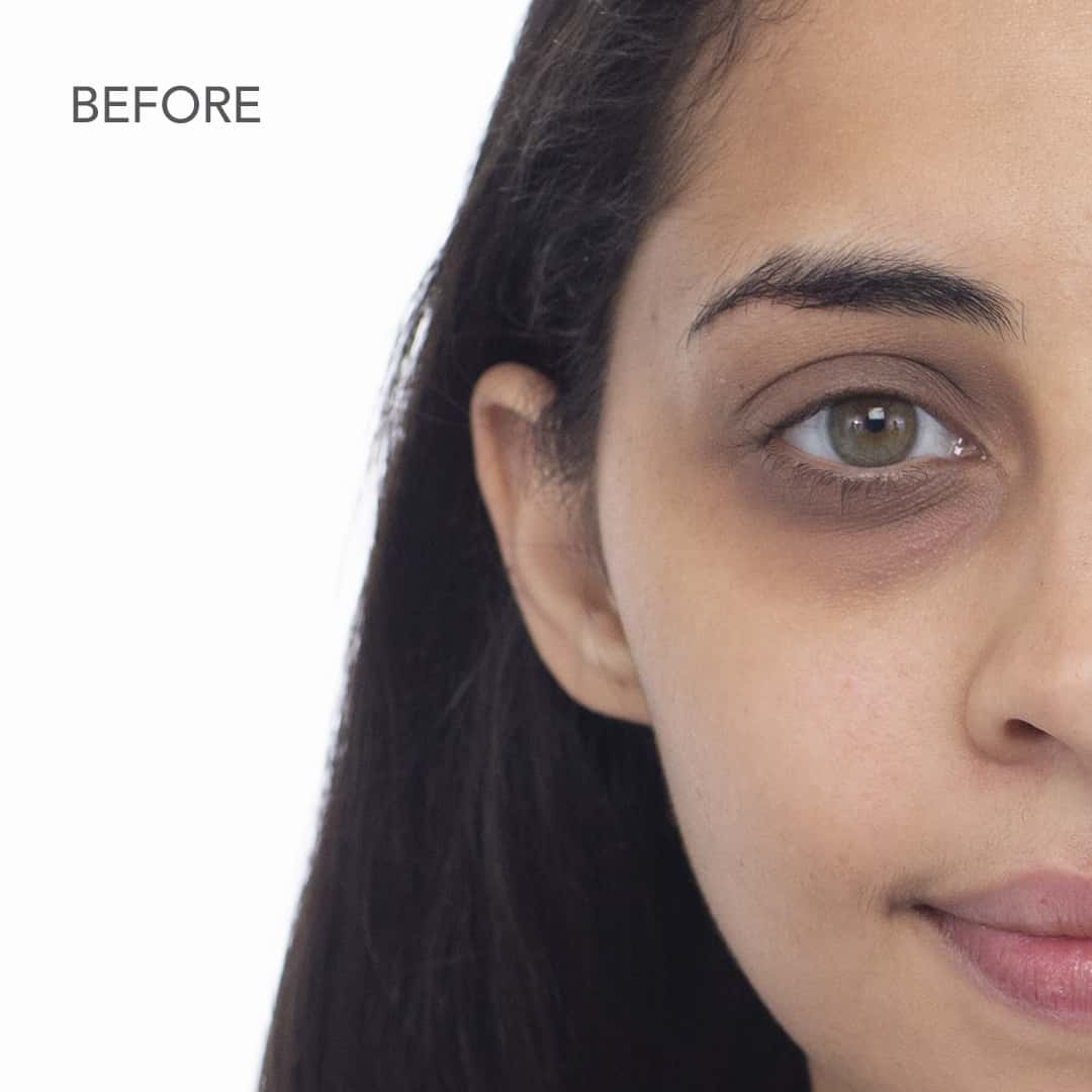 before - how to conceal dark circles